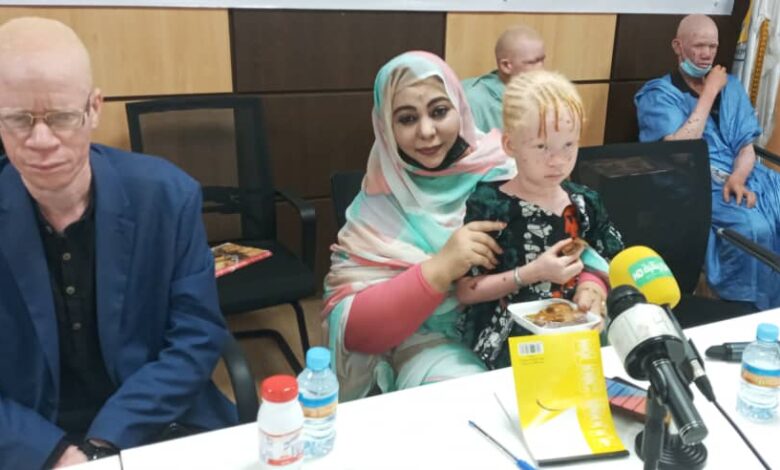 صورة تنظيم ندوة حول “المهق” من طرف المنظمة الموريتانية لدعم ودمج المهق